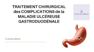 TRAITEMENT CHIRURGICAL DES COMPLICATIONS DE LA MALADIE ULCÉREUSE GASTRODUODÉNALE [upl. by Madea]