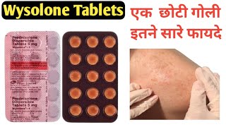 Wysolone Tablets  Wysolone 5 mg Tablet Uses In Hindi  prednisolone tablets [upl. by Chara]