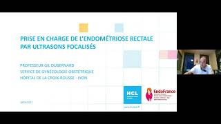 Endométriose  quels traitements en 2021  Webinar HCL [upl. by Ettenoj]