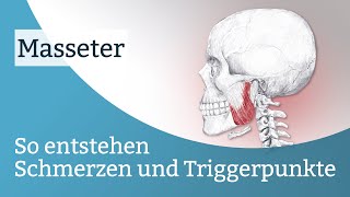 Masseter Schmerzen Triggerpunkte und deren Aktivierung [upl. by Zoltai303]