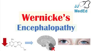 Wernicke’s Encephalopathy  Causes Symptom Triad amp Treatment [upl. by Melisenda]