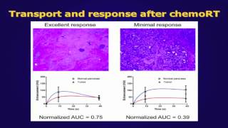 Pancreatic cancer properties describe gemcitabine response [upl. by Kim]