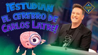 El cerebro de Carlos Latre a estudio  El Hormiguero [upl. by Ariek850]