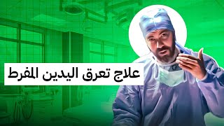 علاج تعرق اليدين المفرط [upl. by Anat]