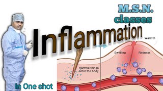 MSNwhat is InflammationMedical surgical nursingpathophysiology of inflammationsteps [upl. by Anilev]