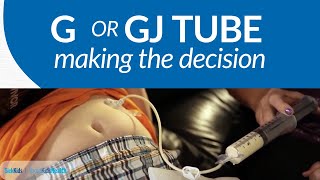 The GGJ Tube Decision  AboutKidsHealth at The Hospital for Sick Children [upl. by Ikcaj]