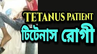 Tetanus patient  টি‌টেনাস রোগী [upl. by Walley]