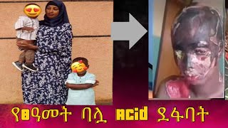 የ8 ዓመት ባሏ Acid ደፋባት🥹 Ayantu Mustefa አያንቱ ሙስጠፋ [upl. by Stiles]