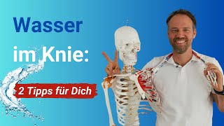 Warum schwillt mein Knie an ➡️ 2 konkrete Tipps gegen Wasser im ArthroseKnie [upl. by Marlene]