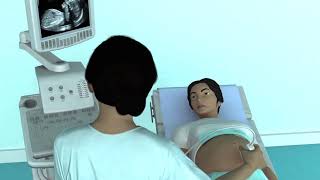 The Basic Steps of an Obstetric Ultrasound Examination [upl. by Duane]