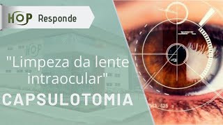 Capsulotomia quotlimpeza da lente intraocularquot [upl. by Adian]