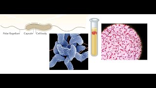 Campylobacter jejuni Part 1 Introduction Biochemical Properties and Virulence factors [upl. by Alram]