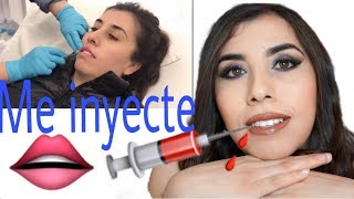 Me Inyecte Los 👄 Mi experiencia [upl. by Ran449]