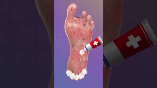 Asmr foot care animation asmr animation cartoon cartoon relax [upl. by Gilpin]