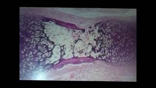 3 CARTILAGO Y HUESO Reconocimiento de laminas histologicas UMSA [upl. by Rew]