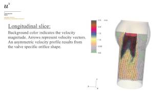 Tomographic PIV behind Aortic Bioprosthesis [upl. by Baggett]