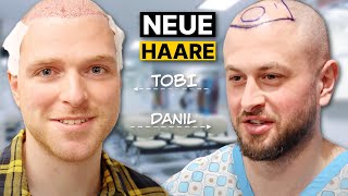 Tobi und Danil wagen den Schritt zur Haartransplantation Stammzellen  Erfahrung [upl. by Onidranreb652]