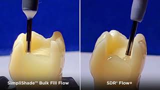 See the Difference SimpliShade™ Bulk Fill Flow vs SDR® flow [upl. by Olds593]