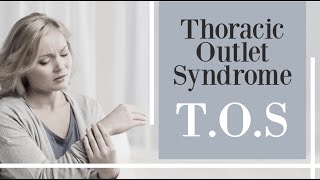 Thoracic Outlet Syndrome  TOS [upl. by Rawlinson]