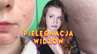 Kosmetolog reaguje na pielęgnację widzów Nie używajcie krwawego peelingu 4 [upl. by Atirrehs]