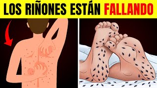 8 EXTRAÑOS Señales de que Tus Riñones Están Pidiendo Ayuda [upl. by Neelloj]