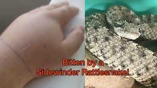 Sidewinder Rattlesnake Bite [upl. by Dorina]