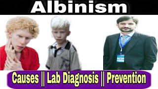 Albinism  Causes  Lab diagnosis  Prevention [upl. by Zehc]