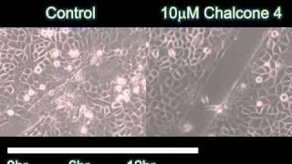 A Pivotal Role for CXCL12 Signaling in HPVMediated Transformation of Keratinocytes [upl. by Matty]