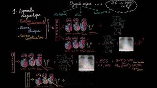 Insuffisance cardiaque aiguë en 3 étapes  Partie 1  Docteur Synapse [upl. by Nylissej]