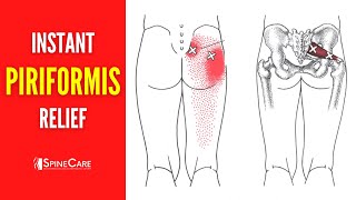 How to Get Rid of Piriformis Pain FOR GOOD [upl. by Hole823]