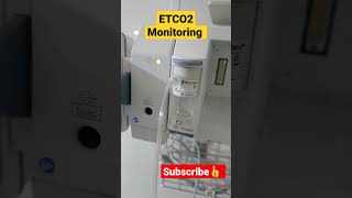 ETCO2 MONITORING  NORMAL RANGE 35 to 45mmhg  VENTILATION shorts vtshorts [upl. by Oz892]