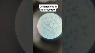 Collenchyma in compound microscope [upl. by Noiraa]