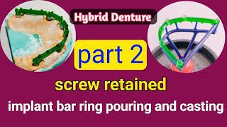 implant bar ring pouring and casting  implant bar hybrid denture  hybriddenture [upl. by Anial]