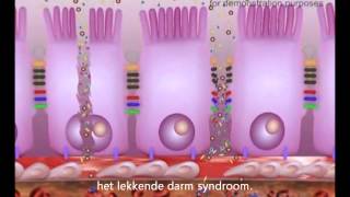 Lekkende Darm  Leaky Gut Syndrome [upl. by Sorenson]