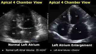 Echocardiography Normal Vs Abnormal Images  Heart Ultrasound  Cardiac ColorSpectral Doppler USG [upl. by Paddie669]