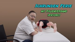 Schrunden Ferse mit Folienverband versorgt [upl. by Macdonell737]