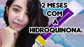 Hidroquinona 4 Resultados Que Tive Até Agora [upl. by Huber]