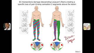 Clinical Significance of Lissauers tract [upl. by Aicirt698]