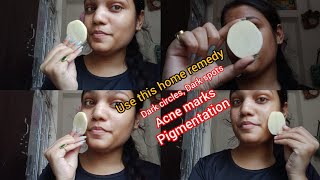 How to remove dark circlesacne pigmentation blemishes in your facenaturalGlow and grow beauty [upl. by Fachanan]