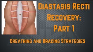 Diastasis Recti Recovery Part 1 Breathing and Bracing Strategies [upl. by Amikay93]