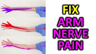 3 Exercise To Relieve Arm Pain Numbness Pins and Needles [upl. by Huskey]