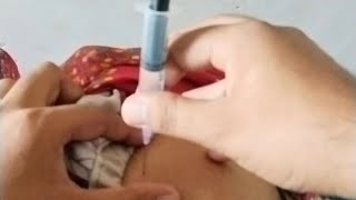 INTRAMUSCULAR INJECTIONS VIDEO PROCEDURE ll INJECTION VIDEO ll BUTTOCKS INJECTION VIDEO FOR WOMEN ll [upl. by Phail]