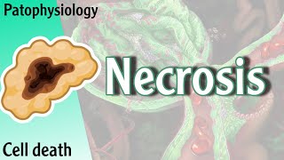 Pathophysiology  Necrosis cell death Hani Laith شرح [upl. by Evans967]