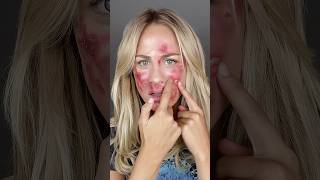 MRSA viralvideo creepy makeup makeuptransformation scary [upl. by Dalohcin]