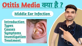 Otitis Media in Hindi  Types Causes Symptoms and Treatment of Otitis Media [upl. by Cave948]