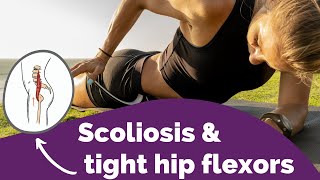 Scoliosis and Tight Hip Flexors  How a Tight Iliopsoas Curves the Spine [upl. by Avraham]