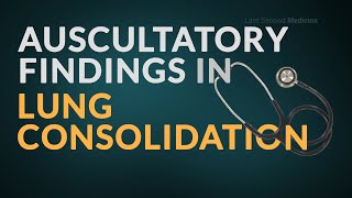 Auscultation Findings in Lung Consolidation  Revise These IMPORTANT FINDINGS [upl. by Atteve]