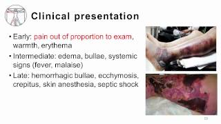 1 Fasciitis and Myositis [upl. by Drofniw]