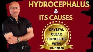 Causes of Hydrocephalus  What is going on in the brain  Dr Najeeb [upl. by Ecinehs871]