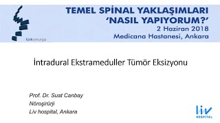 INTRADURAL EKSTRAMEDULLAR KİTLE [upl. by Araht]